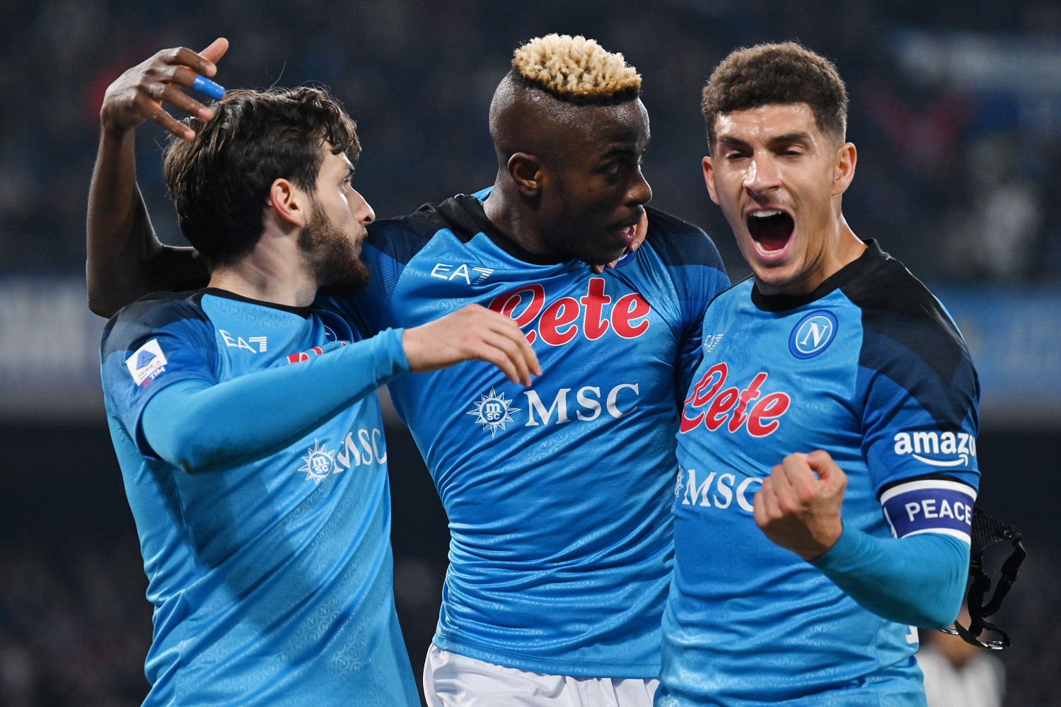 Le probabili formazioni di Napoli-Fiorentina e dove vederla in TV e in streaming